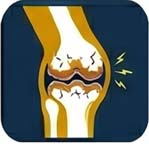 arthritis