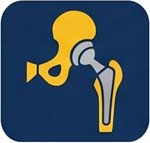 hip replacement