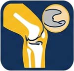 meniscus tear
