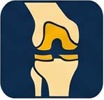 partial knee replacement