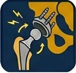 revision hip replacement