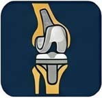 revision knee replacement